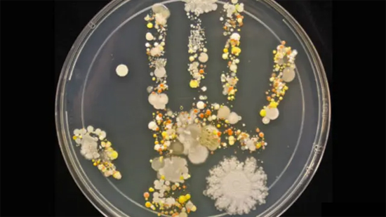 Placa de Petri con colonias de bacterias y hongos creciendo en la forma de una mano, mostrando la diversidad de microorganismos presentes en la piel humana.